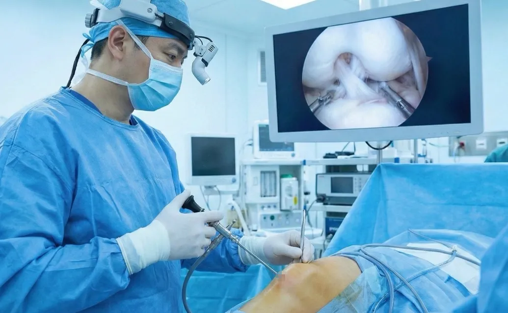 關節鏡精準修復