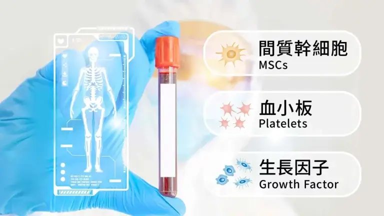 BMAC自體高濃度骨髓濃縮液成分
